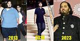 Anant Ambani's Health Issues: a Comprehensive Look