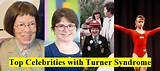 Celebrities with Turner Syndrome | Actresses with Turner Syndrome