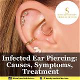 Claire's Ear Piercing Infection: Causes, Symptoms, and Treatment