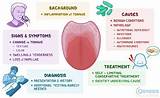 Definitive Guide to Drummond Diagnosis: Symptoms, Causes, and Treatment Options