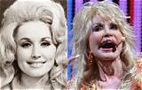 Dolly Parton's Implants: an Inside Look at Her Iconic Enhancements