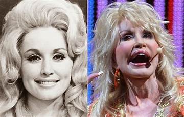 Dolly Parton's Implants: an Inside Look at Her Iconic Enhancements