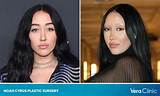 Fact Check: Is Noah Cyrus Asian? Before and After Photos -Everything on Her Mom and More