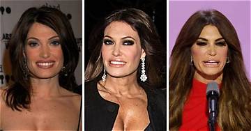 Kimberley Guilfoyle Before: Transformation over the Year's