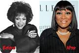 Patti Labelle's Plastic Surgery: Before and After