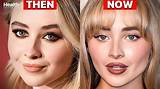 Sabrina Carpenter's Plastic Surgery Journey: a Before and After Transformation