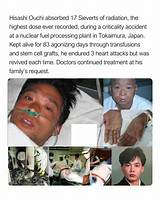 The Tragic "Hisashi Ouchi Case": a Lesson in Nuclear Disaster Management