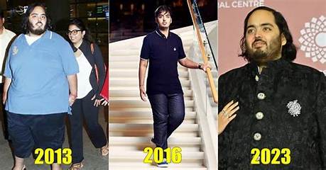 The Unspoken Truth: Anant Ambani's Health Unveiled