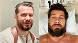 Unveiling Secrets of Steven Crowder's Surgery: Surprising Discoveries
