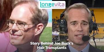 Unveiling the Inspiring Story Behind Joe Buck's Wife: Discoveries and Insights